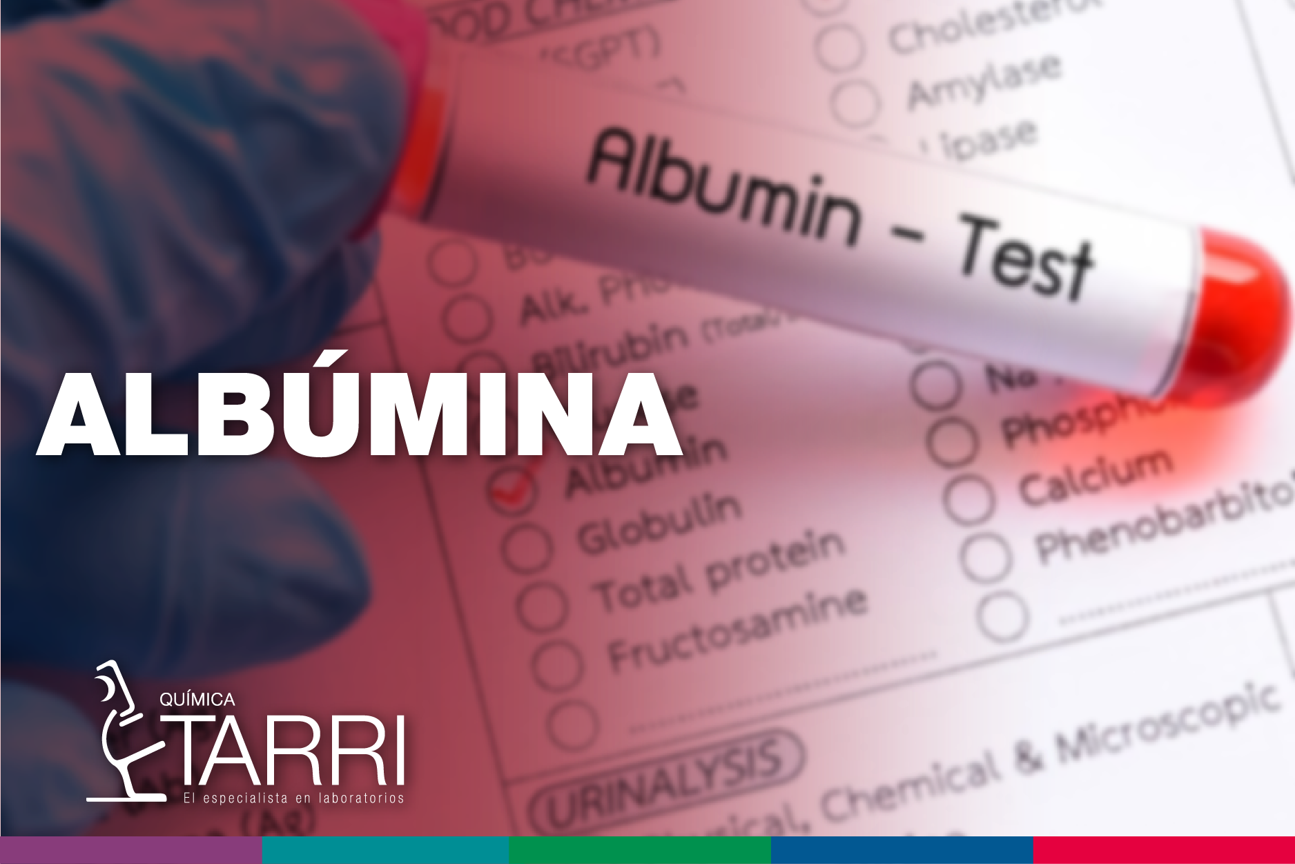 Albúmina Química Tarri